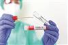 Odisha News:Covid-19-Cases-on-the-Rise-in-India