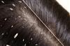 Odisha News:Tragedy-in-Puri-12-Year-Old-Succumbs-to-Severe-Scalp-Infection